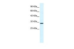 ZNHIT6 Rabbit anti-Human, Polyclonal, Novus Biologicals 0.1ml; Unconjugated:Antibodies,